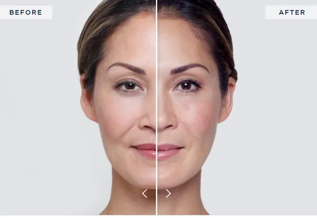 Where to Get Skin Tightening: