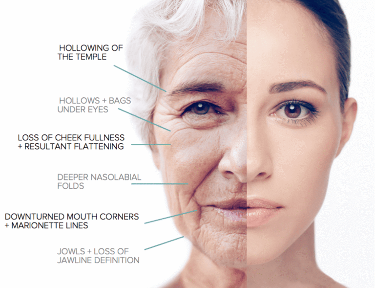 Achieve Youthful and Radiant Skin with Opalnirvana.com Dermal Fillers: A Complete Guide